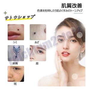美顔器 ピコレーザー 美顔器 ほくろそばかす除去の詳細画像4