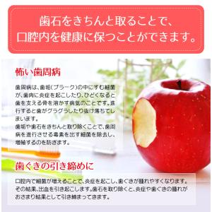 歯石取り スケーラー H5-33 実際に歯科医...の詳細画像4