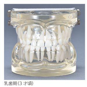 2個 歯列模型 実物大 開閉式 乳歯期 永久歯萌出前 永久歯 交換期 模型 歯科 透明乳歯 永久歯交換期模型 永久歯萌出前(4〜6歳頃) : 歯科医院専売品