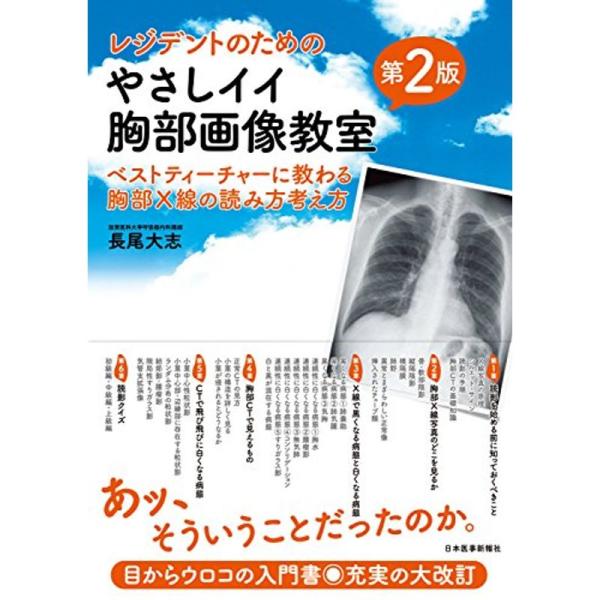 レジデントのためのやさしイイ胸部画像教室ベストティーチャーに教わる胸部X線の読み方考え方 改訂第2版