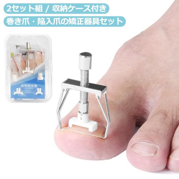 【2セット組】 足の巻き爪のセルフ矯正 ツール セット 陥入爪 サポーター 爪 矯正器具 5種の爪押...