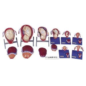 妊娠 子宮模型の商品画像