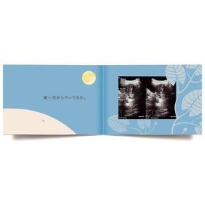 エコー写真 アルバム 10ツキ10カものがたり...の詳細画像1