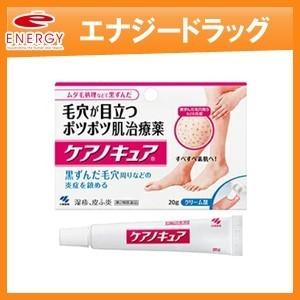 【3個セット】【第2類医薬品】【小林製薬】ケアノキュア 20g×3個セット　 ※セルフメディケーショ...