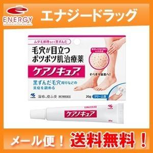 【第2類医薬品】【送料無料】【小林製薬】ケアノキュア 20g ※セルフメディケーション税制対象医薬品