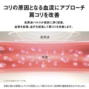 パナソニック Panasonic 高周波治療器...の詳細画像4
