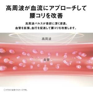 パナソニック Panasonic 高周波治療器...の詳細画像5