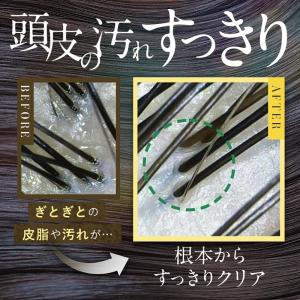 2個セット ULRUB ウルラブ ヘッドスクラ...の詳細画像3
