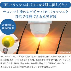 ヤーマン 脱毛器 レイボーテ レイボーテヴィー...の詳細画像5