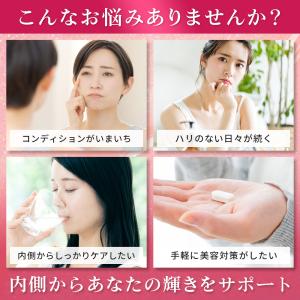 爆買 NMN5-ALA PQQアスタキサンチン...の詳細画像2