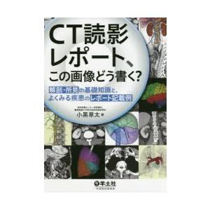 CT読影レポート、この画像どう書く?　解剖・所見の基礎知識と、よくみる疾患のレポート記載例　小黒草太...