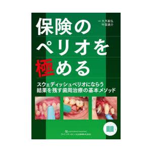 保険のペリオを極める スウェディッシュペリオにな...の商品画像