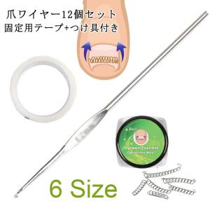 テーピング 矯正器具 爪ワイヤー 矯正 12個セ...の商品画像