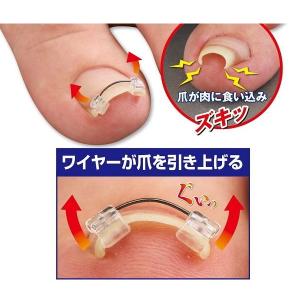 一般医療機器　巻き爪ワイヤーガード 足指 親指 巻き爪 引き上げ クセづけ 巻き爪対策 食い込み防止 圧迫防止 ワイヤーガード｜dragon-bee