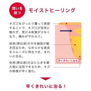 バンドエイド キズパワーパッド スポットタイプ10枚の詳細画像2