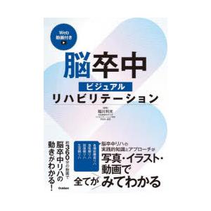 脳卒中ビジュアルリハビリテーション