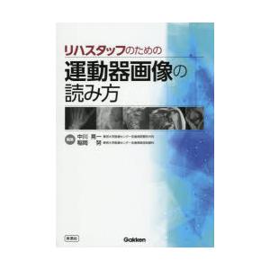 リハスタッフのための運動器画像の読み方