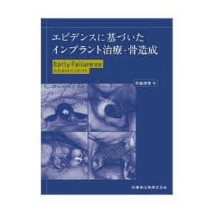 エビデンスに基づいたインプラント治療・骨造成 Early Failure回避のためのコンセプト