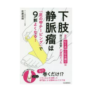下肢静脈瘤は「足の甲テーピング」で9割よくなる! 足のむくみ・こむら返りは“抜け道血管”が原因だった