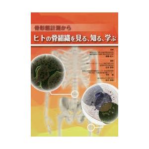 骨形態計測からヒトの骨組織を見る、知る、学ぶ｜dss