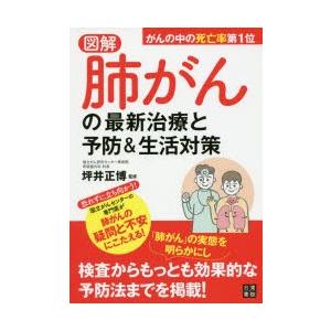 図解肺がんの最新治療と予防＆生活対策｜dss