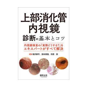 上部消化管内視鏡診断の基本とコツ 内視鏡検査の「実際どうする?」をエキスパートがすべて解決