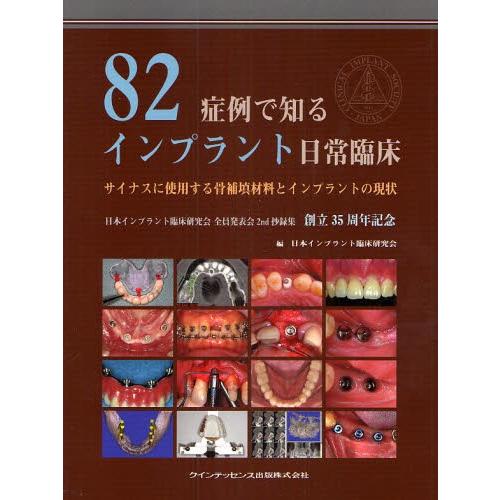 82症例で知るインプラント日常臨床 サイナスに使用する骨補填材料とインプラントの現状 日本インプラン...