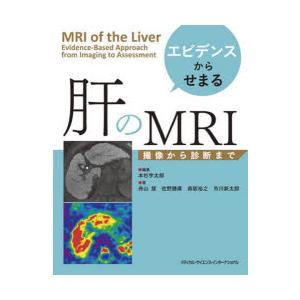 エビデンスからせまる肝のMRI 撮像から診断まで