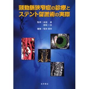 頸動脈狭窄症の診療とステント留置術の実際｜dss