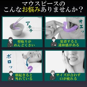 歯ぎしり マウスピース 薄型タイプ シズカネル...の詳細画像1