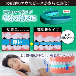 歯ぎしり マウスピース 薄型タイプ シズカネル...の詳細画像3