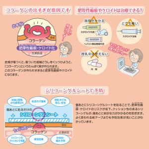 レディケア16 国内正規品 帝王切開 傷 テー...の詳細画像5