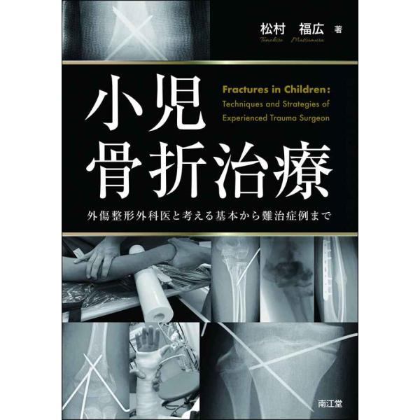 小児骨折治療: 外傷整形外科医と考える基本から難治症例まで