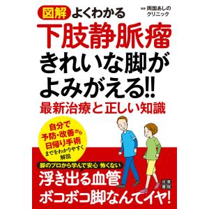 図解 よくわかる下肢静脈瘤 きれいな脚がよみがえる!! 最新治療と正しい知識 電子書籍版 / 監修:両国あしのクリニック｜ebookjapan