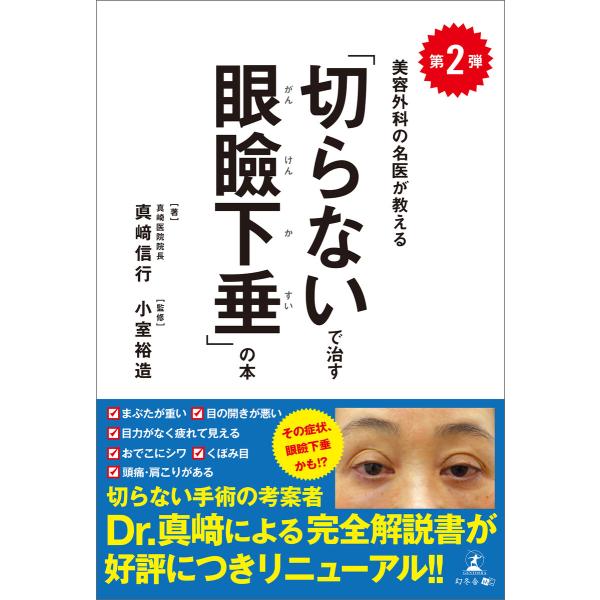 第2弾 美容外科の名医が教える「切らないで治す眼瞼下垂」の本 電子書籍版 / 著:真崎信行 監修:小...