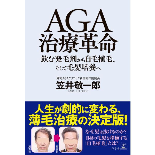 AGA治療革命 飲む発毛剤から自毛植毛、そして毛髪培養へ 電子書籍版 / 著:笠井敬一郎