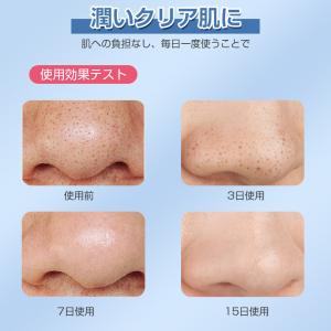 毛穴吸引器 毛穴美顔器 保湿 毛穴ケア 水槽分...の詳細画像4