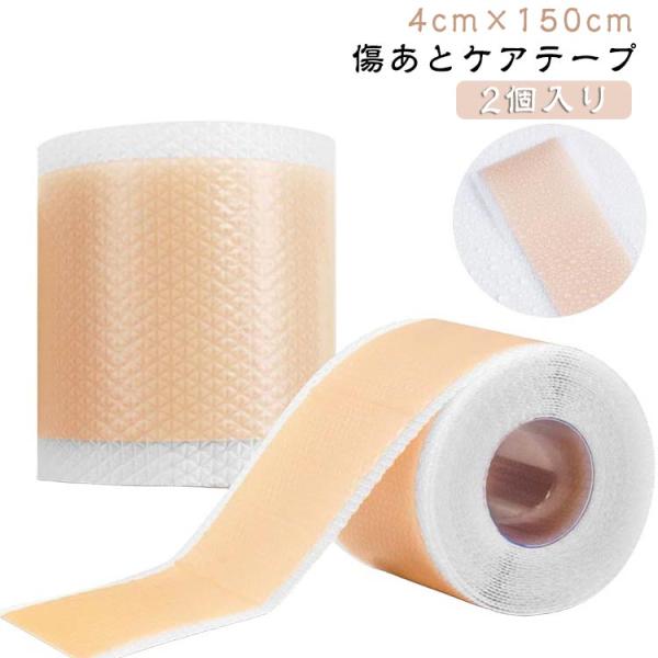 テープ 傷あとケア用シリコンジェルシート 刺青隠し ケロイド 傷あとケアテープ 手術後 4cm×15...