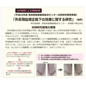 靴下 外反母趾予防 履くだけで足の指がラクにひ...の詳細画像2