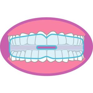 東京企画販売 いびきマウスガード TKSM-018の詳細画像4