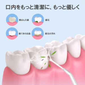 口腔洗浄器 USB充電式 マウスウォッシャー ...の詳細画像1