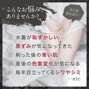 デリケートゾーンケア 黒ずみクリーム (モンド...の詳細画像5