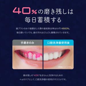 口腔洗浄器 ジェットウォッシャー (現役歯科医...の詳細画像5