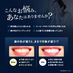ホワイトニング 歯磨き粉 (モンドセレクション...の詳細画像4