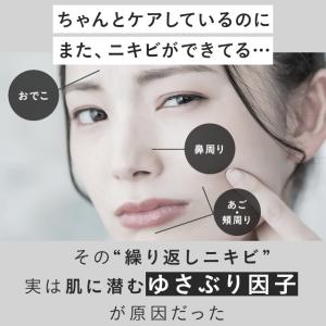 アクネケア ジェル乳液 医薬部外品 1本 ニキ...の詳細画像2