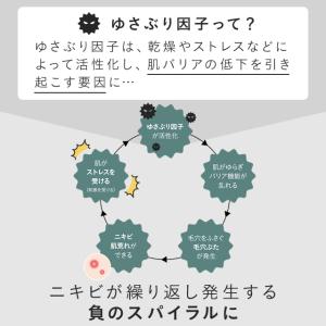 アクネケア ジェル乳液 医薬部外品 3本 ニキ...の詳細画像3
