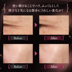 アドバンスト ビューティ コンセントレート1本...の詳細画像3