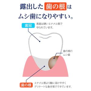 ライオン デント チェックアップ ルートケアα...の詳細画像2