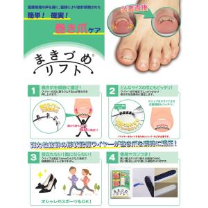 まきづめリフト (メール便送料無料) 巻き爪ケ...の詳細画像1