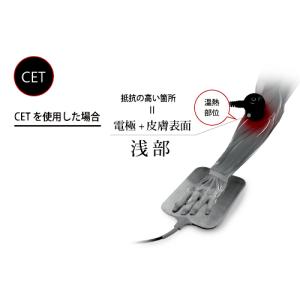 フィジオ ラジオスティムプロ P-RF-PRO...の詳細画像4